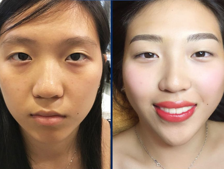 Trước và sau khi làm lông mày tại Bệnh viện thẩm mỹ Kangnam 