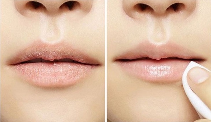 Cần tẩy da chết thường xuyên để lấy lại đôi môi mịn màng, căng mọng