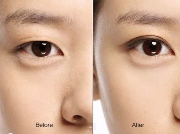 Trước và sau khi kẻ eyeliner cho mắt sụp mí