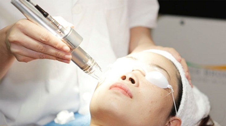 Việc trị nám bằng laser có thể tiềm ẩn nhiều vấn đề về da