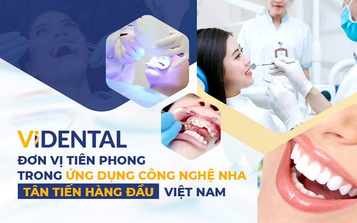Niềng răng invisalign Hà Nội tại Nha khoa Vidental