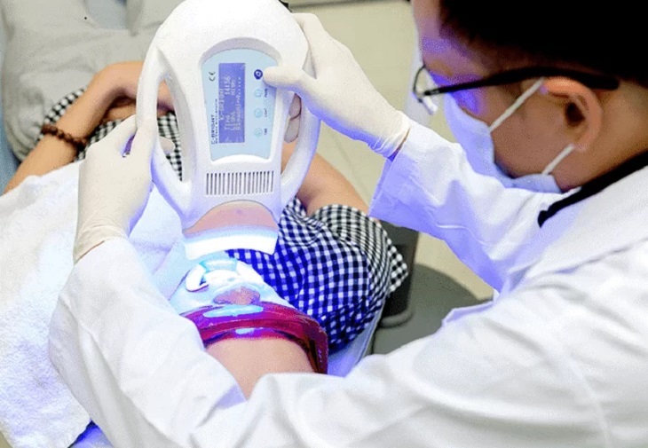 Dịch vụ tẩy trắng răng tại Nha khoa Kim