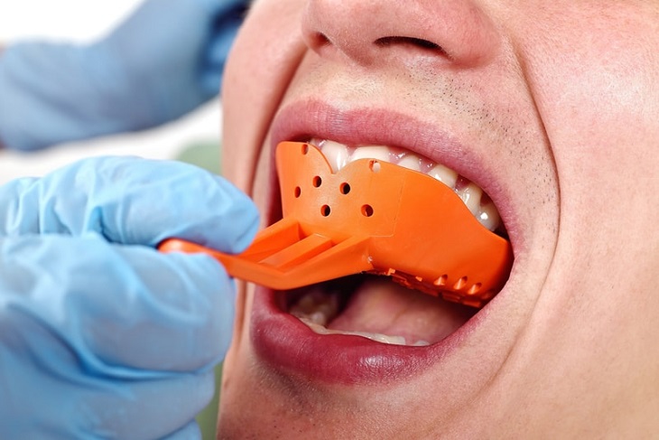 Quy trình niềng răng sứ cũng tương tự như những phương pháp niềng mắc cài khác