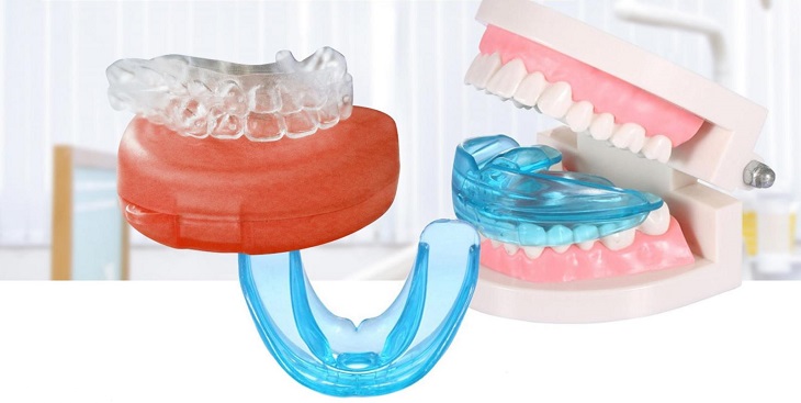 Niềng răng silicon là phương pháp niềng răng không dùng mắc cài và dây cung
