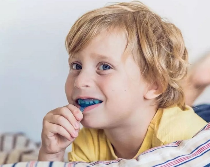 Chi phí niềng răng còn phụ thuộc vào tình trạng răng miệng của trẻ