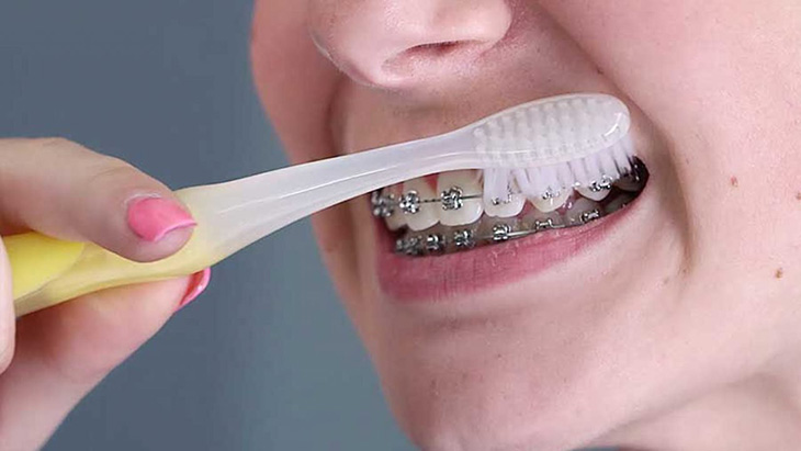 Vệ sinh răng miệng, ăn uống khoa học cũng giúp hàm răng thêm khỏe mạnh