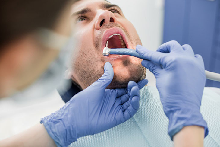 Niềng răng khểnh có phải nhổ răng không phụ thuộc vào nhiều yếu tố