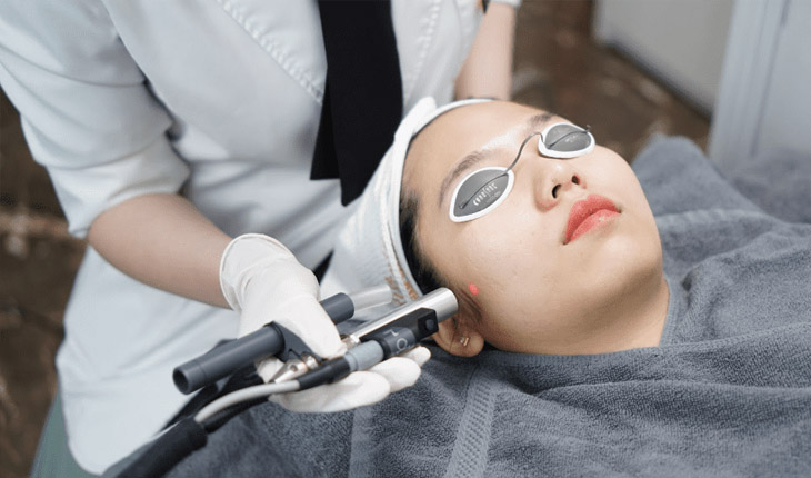 Bắn laser trị sẹo là phương pháp điều trị phổ biến
