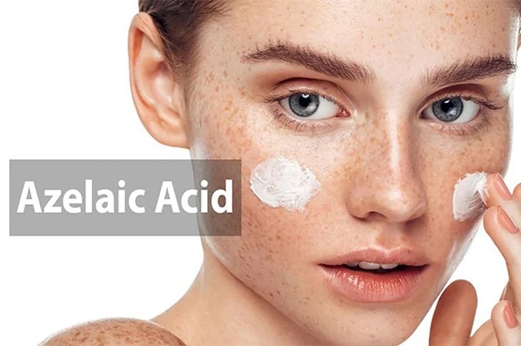 Acid Azelaic hỗ trợ điều trị nám hiệu quả